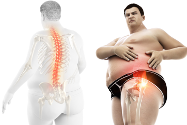 Sciatic Nerve Pain In The Hip