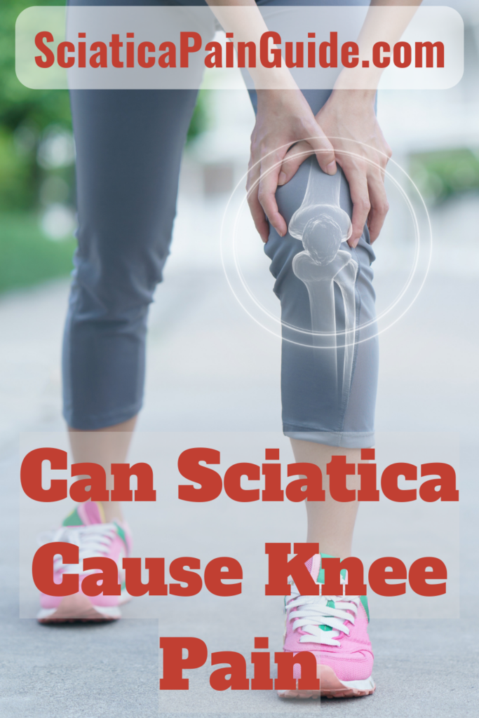 Can Sciatica Cause Knee Pain Sciatica Pain Guide