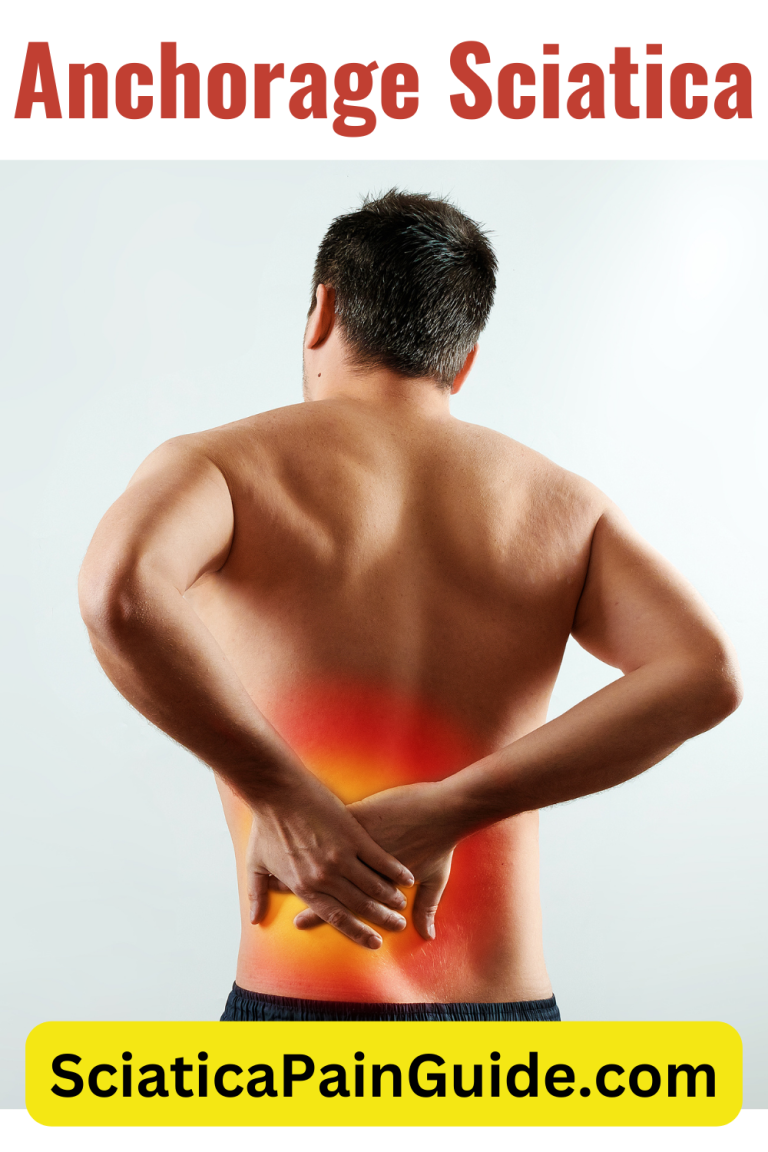 anchorage-sciatica-sciatica-pain-guide