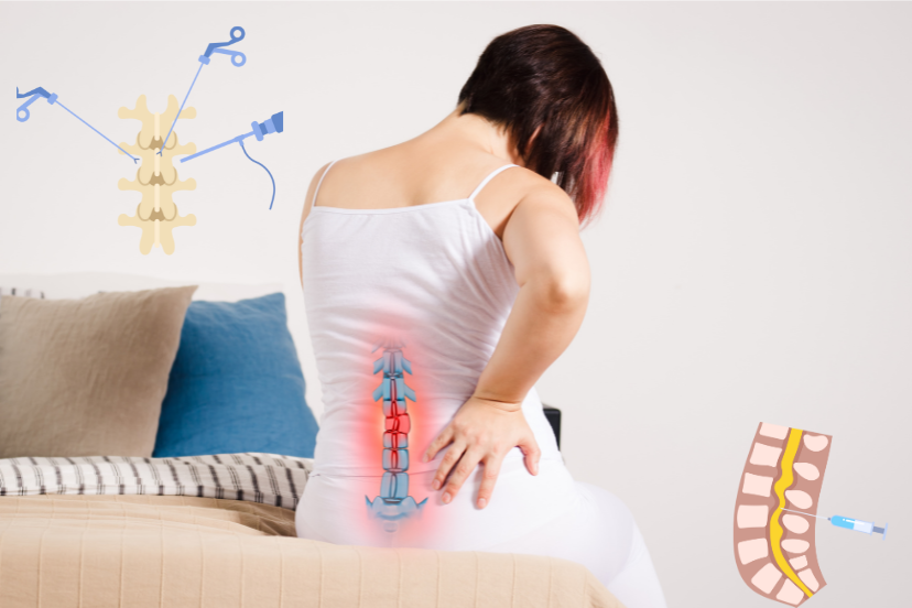 Nerve Block for Sciatica