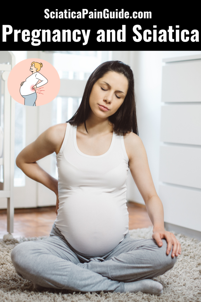 icd 10 sciatica pain in pregnancy