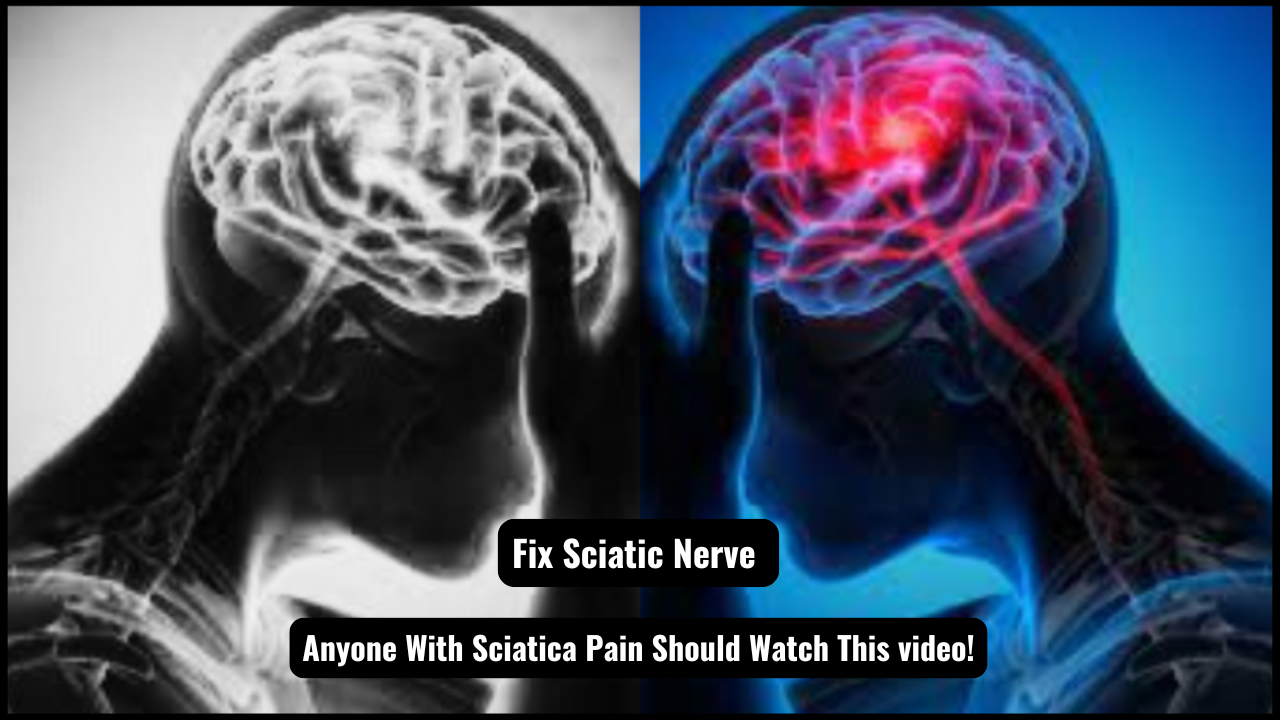 Fix Sciatic Nerve