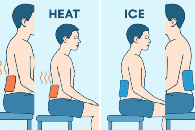 heat or ice for sciatica nerve pain