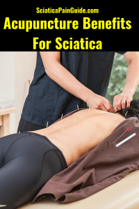 Acupuncture Benefits for Sciatica